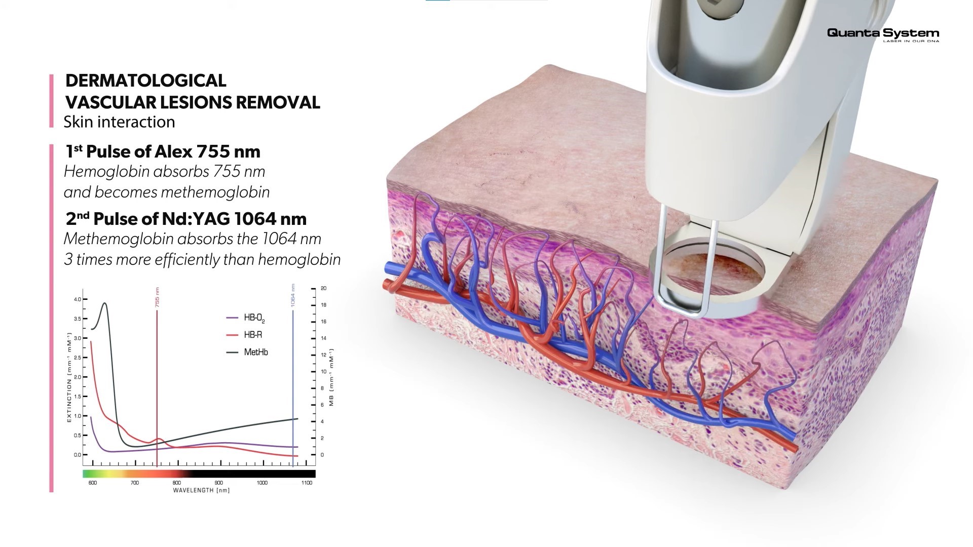 Laser removal of neoplasms: wart, papilloma, hemangioma at Maska Salon